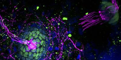 Hair cells Mechanosensory hair cells in a zebrafish embryo Image credit: Peu Santra, Amack lab