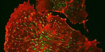 Actin filaments (red) and focal adhesions (green) in a kidney cell that is involved in filtering out toxic waste. Image credit: Jing Bi Karchin and Mira Krendel