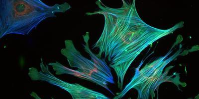 Actin cytoskeleton in mouse tumor fibroblasts. Image credit: Greg Goreczny, Turner lab