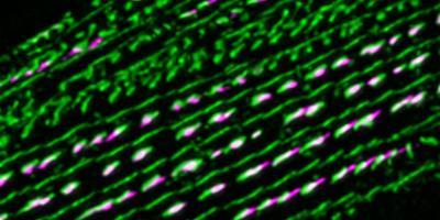 Integrin (green) and alpha-actinin (magenta) in worm muscle. Image credit: Sumana Sundaramurthy, Pruyne lab